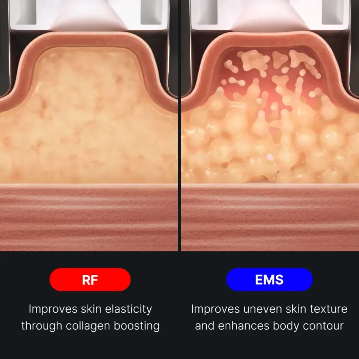 AGE-R Contour Body Shot - Image 5