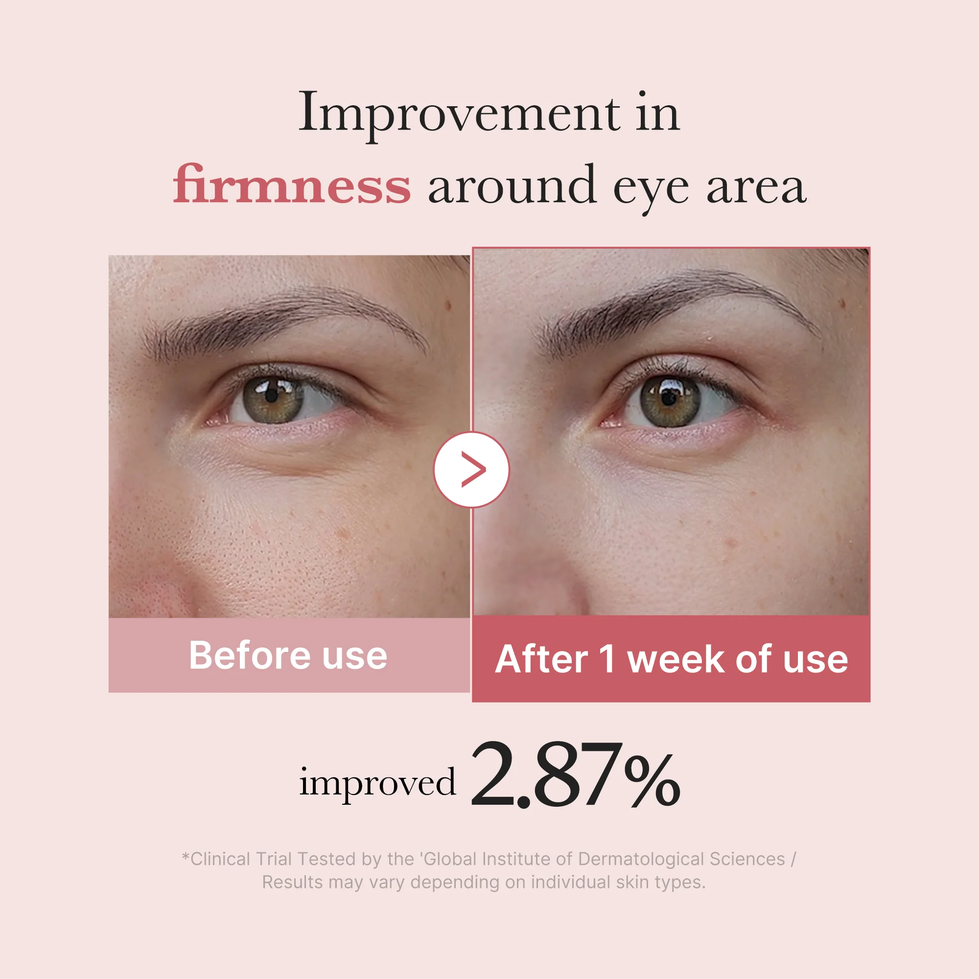 [Subscr.] PDRN Pink Peptide Eye Cream - Image 4