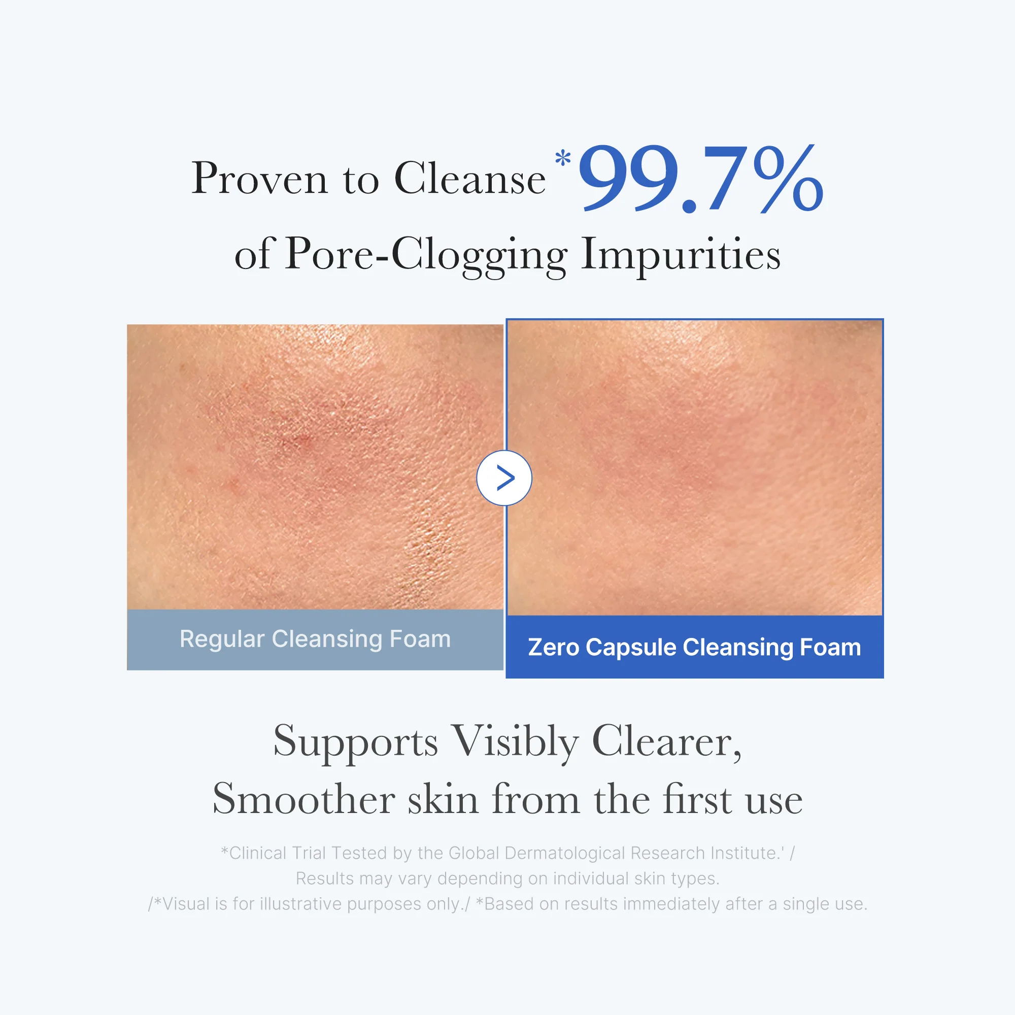 [GIFT] Zero Pore Capsule Cleansing Foam - Image 3