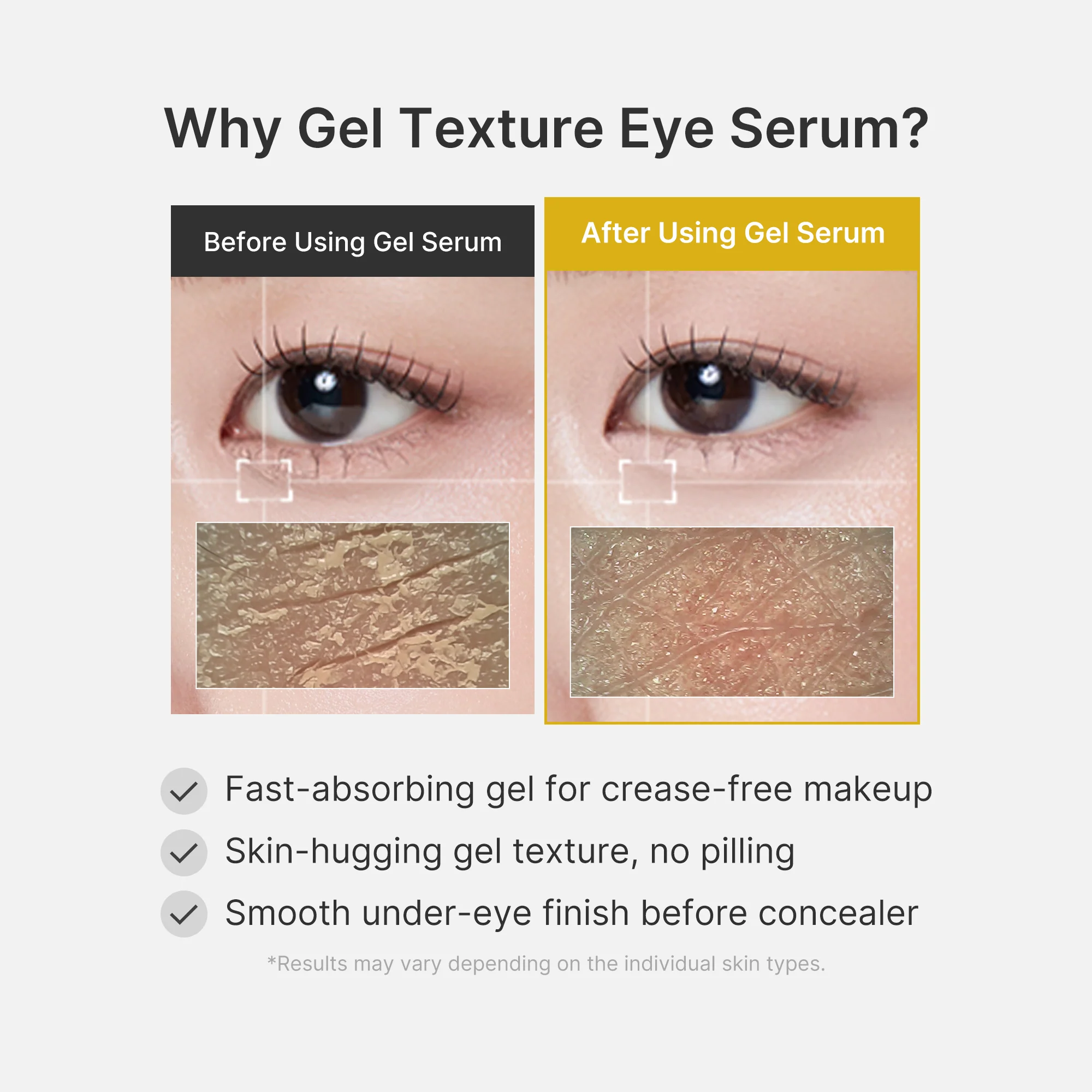 Kojic Acid Tumeric Eye Gel Serum - Image 6