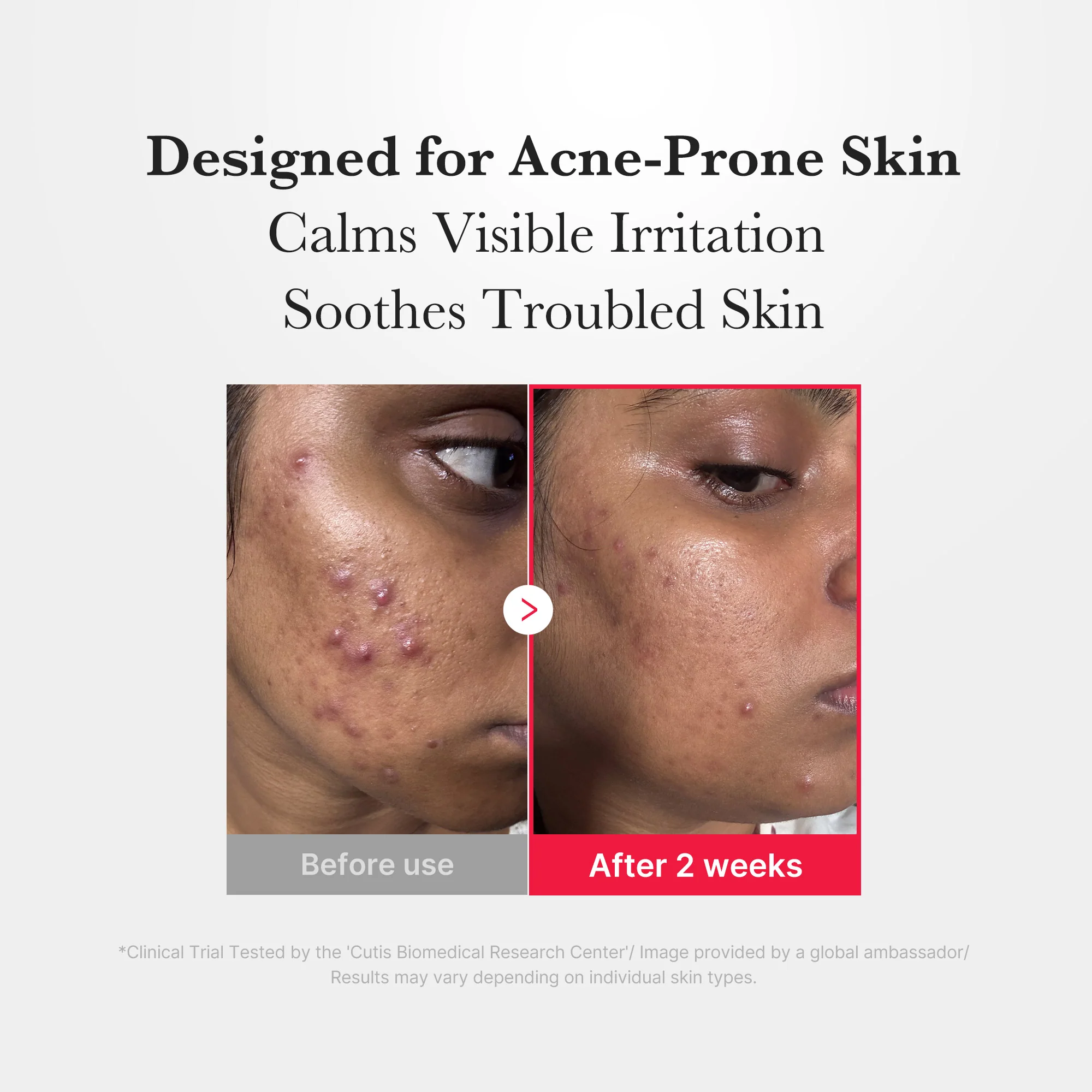 [Subscr.] Hypochlorous Acid Power Soothing Spray - Image 5