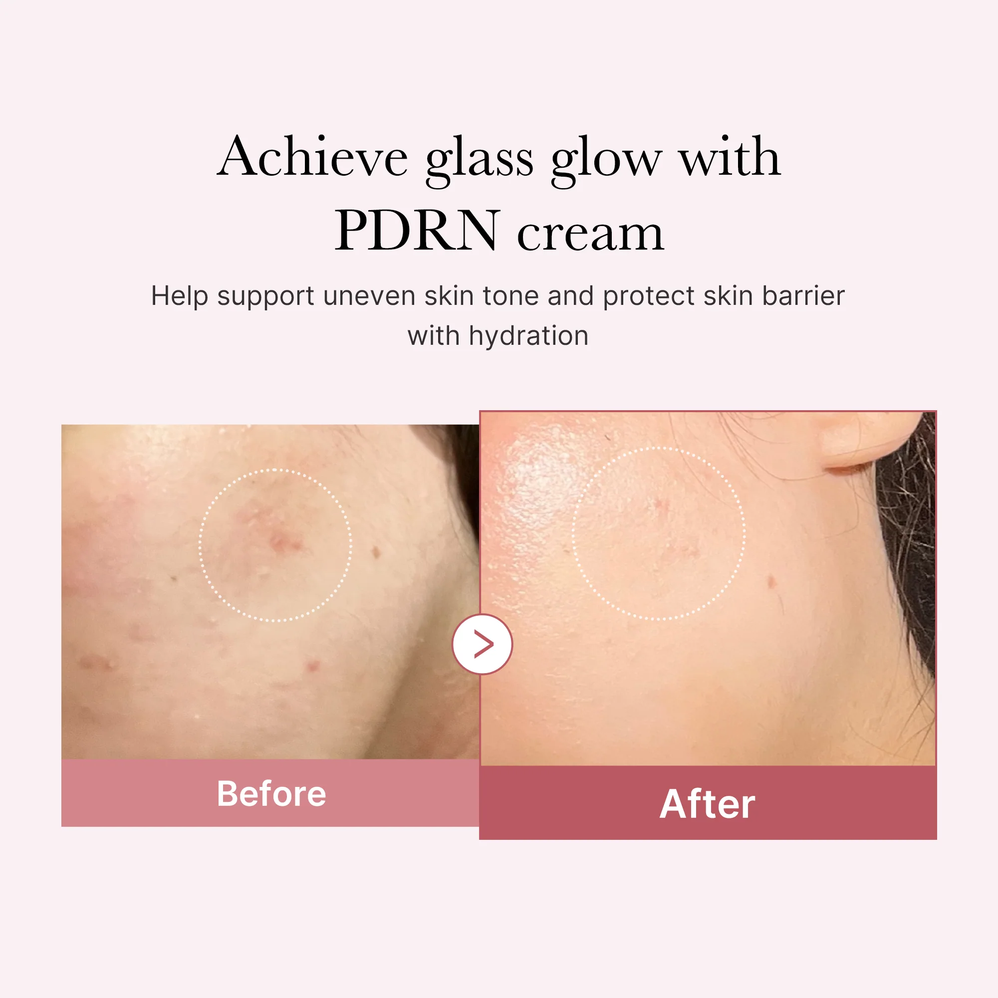 [Subscr.] PDRN Pink Peptide Cream - Image 3