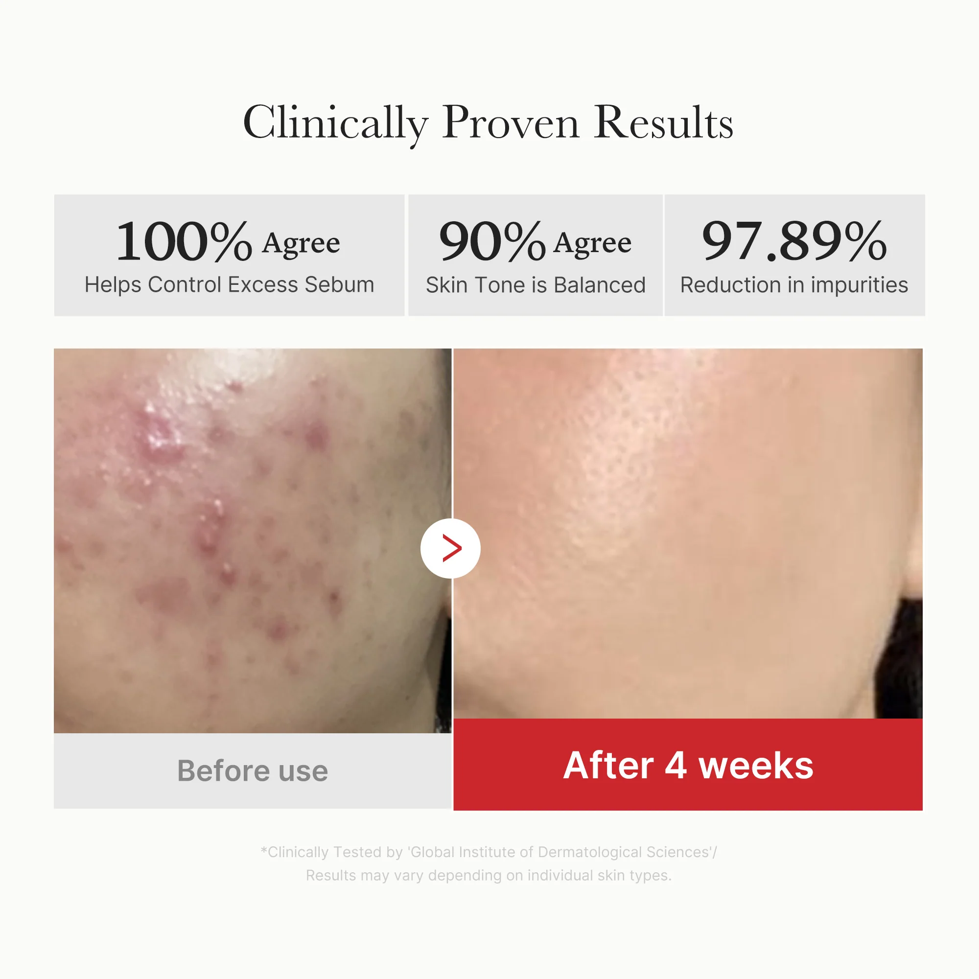 [Subscr.] Red Succinic Acid Panthenol Pads - Image 4