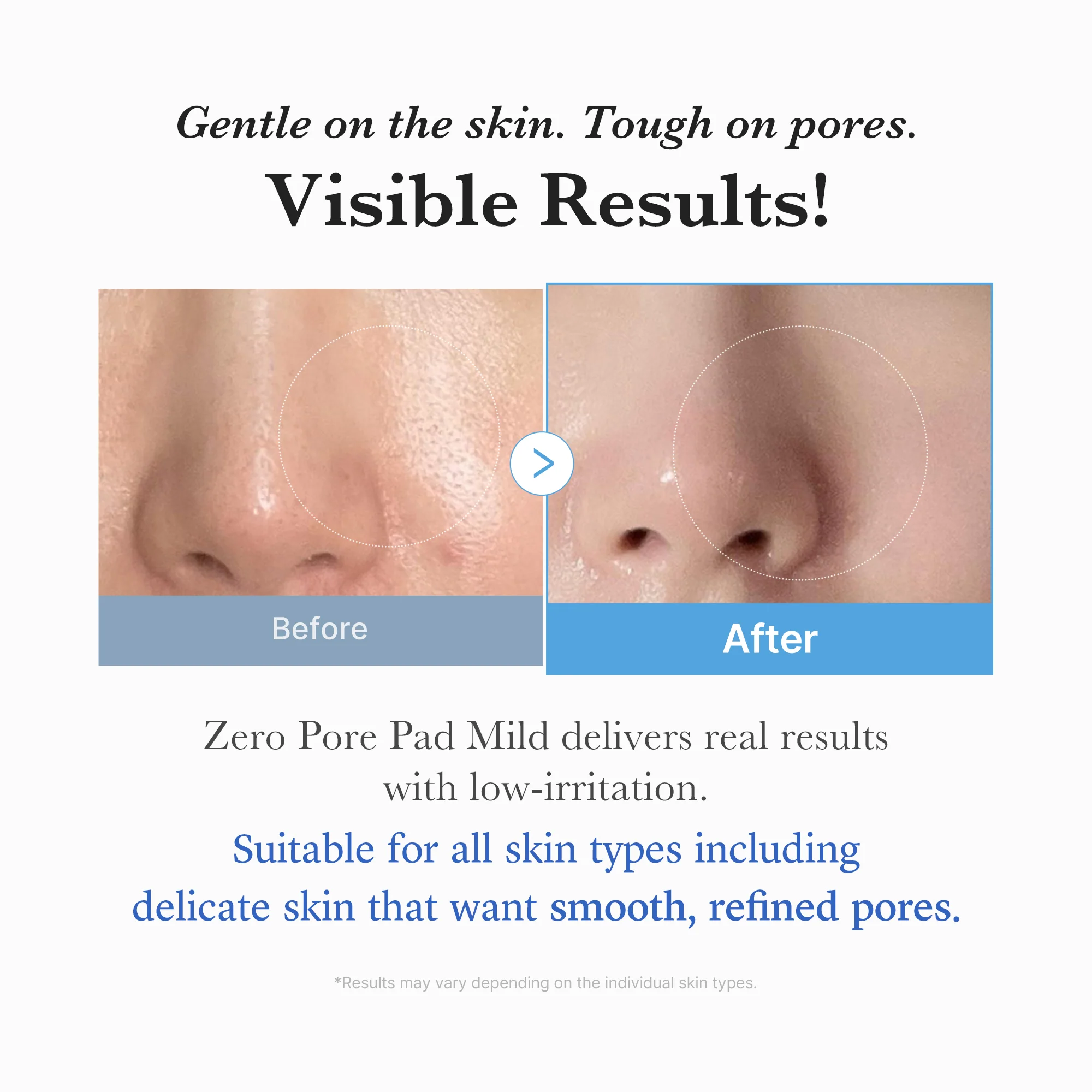 [Subscr.] Zero Pore Madecassoside Pads (Mild) - Image 5